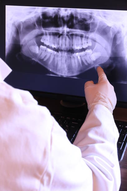 Best Emergency Dental Extractions in Key West, FL
